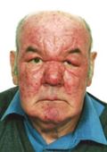 Mirko Ratešić (72)
